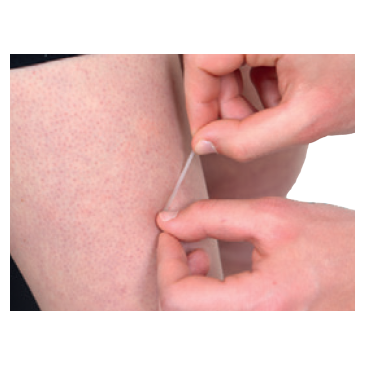 LOT DE 5 SUTURES 3 MM X 75 MM POWERCARE POWERSHOT 