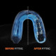 Protège-dents GEL MAX SHOCK DOCTOR
