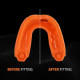 Protège-dents GEL MAX Adulte noir orange SHOCK DOCTOR
